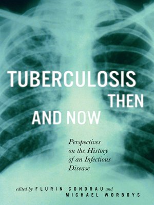 cover image of Tuberculosis Then and Now